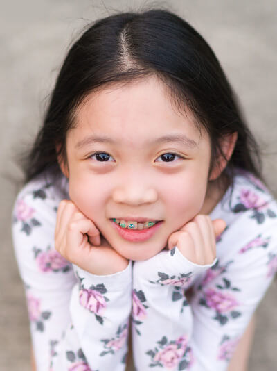 early orthodontic treatment