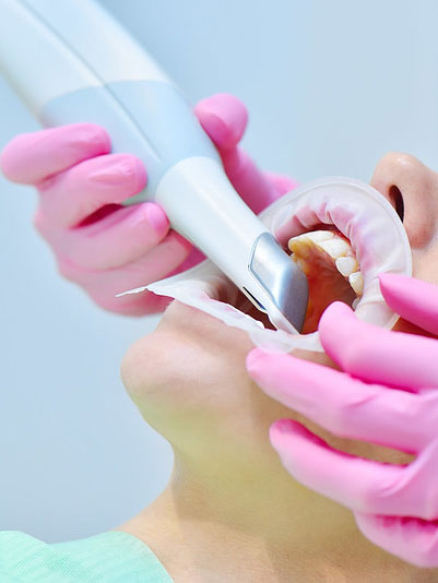 trios intraoral scanner